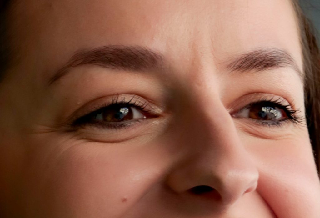 How Stress and Lifestyle Accelerate Facial Ageing — and What You Can Do About It