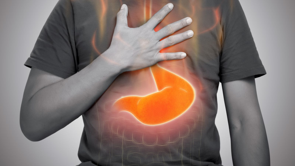 Best Acid Reflux Diet Book