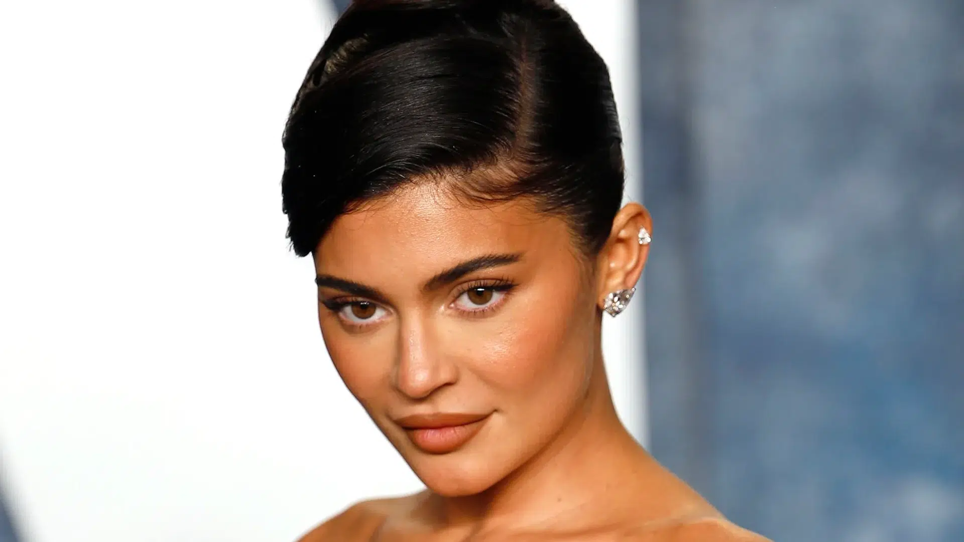 Kylie Jenner after plastic surgery