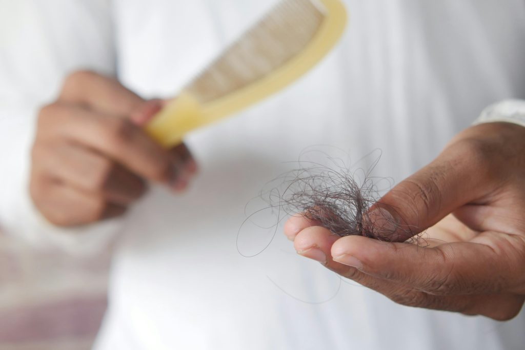 Hair Shedding vs Hair Loss: When Daily Fall Becomes a Real Concern