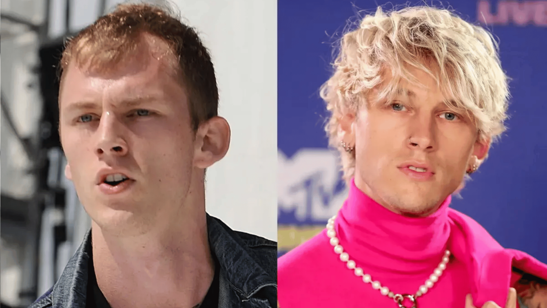 m g kelly before and after hair transplant