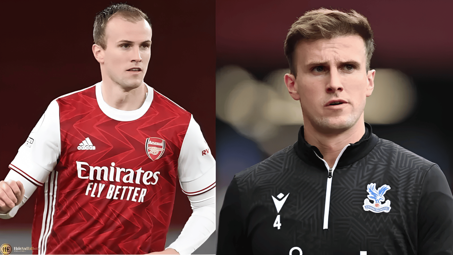 rob holding before and after hair transplant
