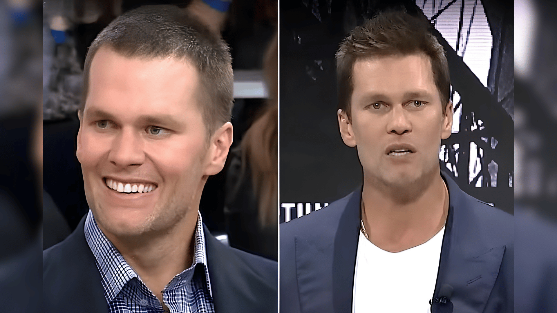 tom brady hairline comparison