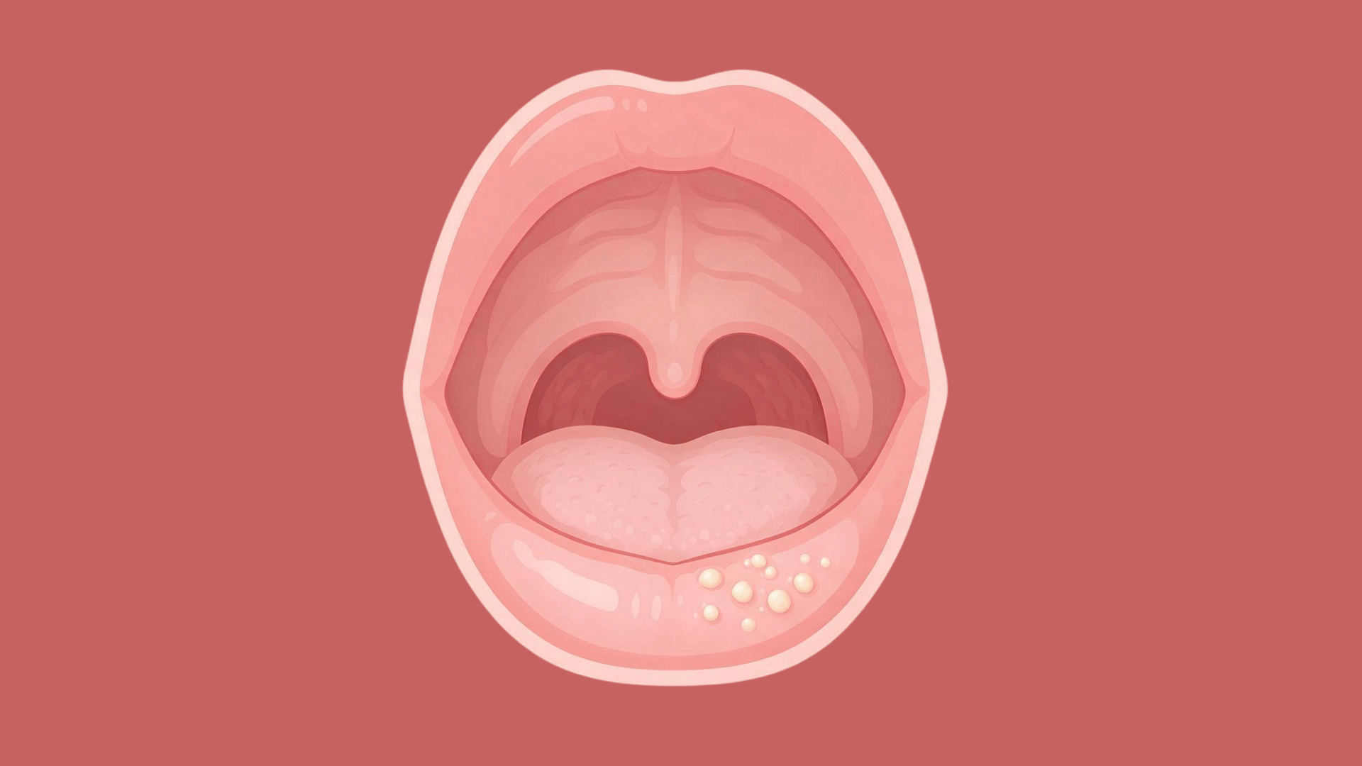 small fordyce spots visible inside the lower lip