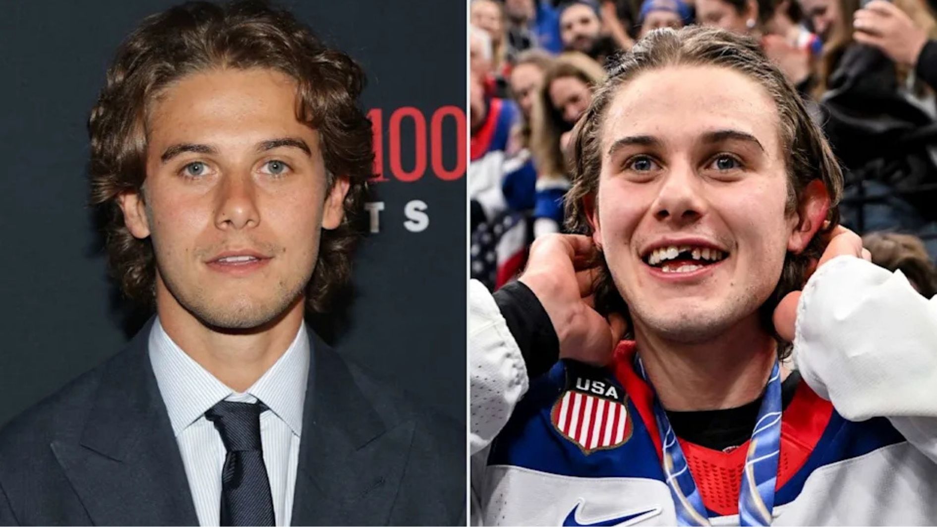 jack hughes photos before and after the injury
