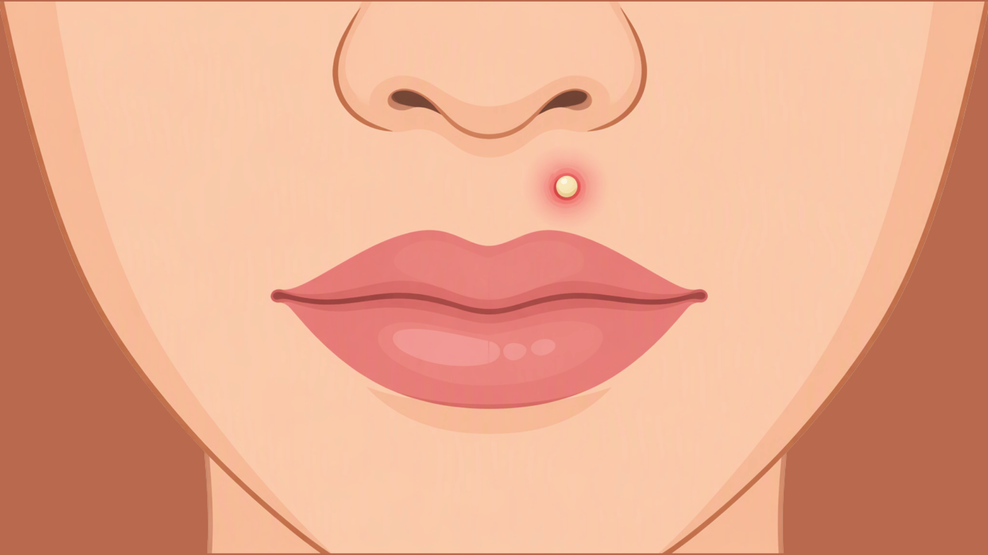 inflamed pimple with a white center on the upper lip