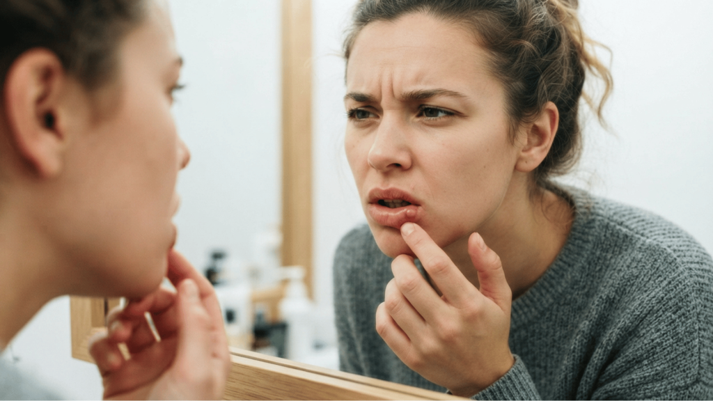 woman checking a small lip bump in the mirror and wondering why do i have a bump on my lip